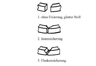 Fixierungsarten